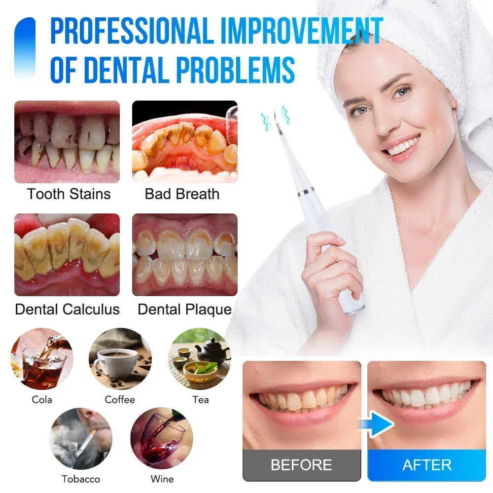 Ultrasonic Scaler for Teeth Cleaning