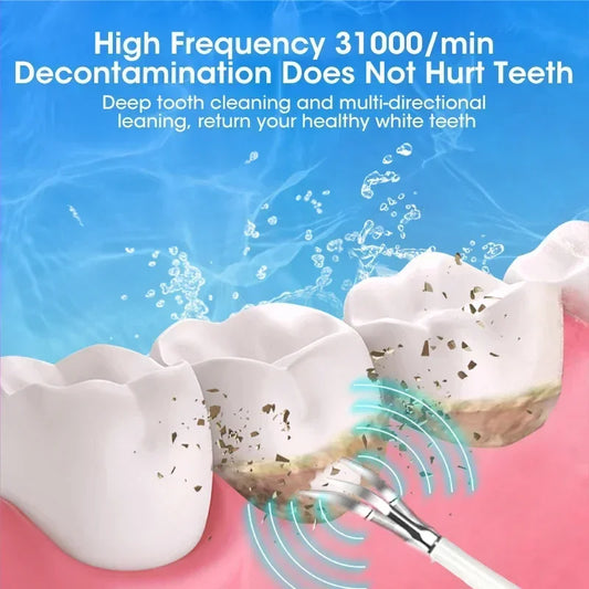 Ultrasonic Scaler for Teeth Cleaning
